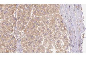 ABIN6273781 at 1/100 staining Human Melanoma tissue by IHC-P. (FGF19 anticorps  (C-Term))