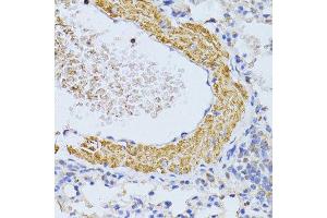 Immunohistochemistry of paraffin-embedded mouse lung using CYCS antibody. (Cytochrome C anticorps  (AA 1-105))