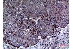 Immunohistochemistry (IHC) analysis of paraffin-embedded Human Lung, antibody was diluted at 1:100.