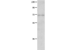 Western Blot analysis of Human fetal lung tissue using IGF2BP1 Polyclonal Antibody at dilution of 1:500