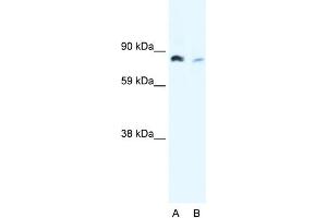 WB Suggested Anti-NFKB2 Antibody Titration:  0. (NFKB2 anticorps  (N-Term))