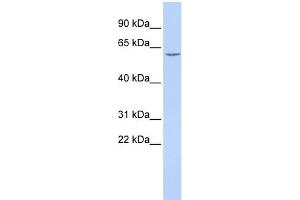 WB Suggested Anti-CES7 Antibody Titration:  0. (CES5A anticorps  (Middle Region))