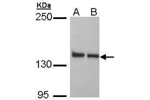 WB Image Sample (30 ug of whole cell lysate) A: H1299 B: HeLa 5% SDS PAGE antibody diluted at 1:1000 (LRPPRC anticorps)