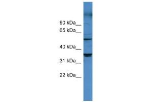 WB Suggested Anti-CYP11B1 Antibody Titration: 0. (CYP11B1 anticorps  (Middle Region))
