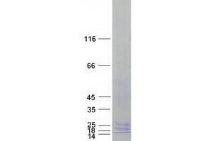 Validation with Western Blot