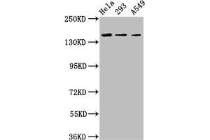 Western Blot Positive WB detected in: Hela whole cell lysate, 293 whole cell lysate, A549 whole cell lysate All lanes: CDON antibody at 3. (CDON anticorps  (AA 1095-1211))