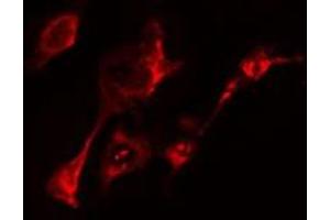 ABIN6275460 staining  HeLa cells by IF/ICC. (RAB20 anticorps  (Internal Region))