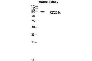 Western Blot (WB) analysis of Mouse Kidney lysis using CD203c antibody.
