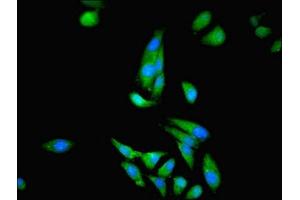 Immunofluorescent analysis of Hela cells using ABIN7148658 at dilution of 1:100 and Alexa Fluor 488-congugated AffiniPure Goat Anti-Rabbit IgG(H+L) (CKB anticorps  (AA 2-270))