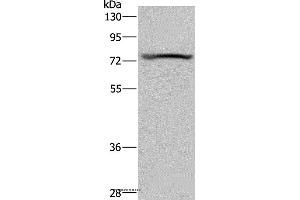 Western blot analysis of Mouse heart tissue, using KCNQ1 Polyclonal Antibody at dilution of 1:200 (KCNQ1 anticorps)