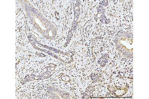 IHC analysis of MOV10 using anti-MOV10 antibody (ABIN7600236). (MOV10 anticorps  (AA 167-772))