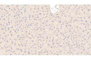 Detection of b2M in Mouse Liver Tissue using Polyclonal Antibody to Beta-2-Microglobulin (b2M)
