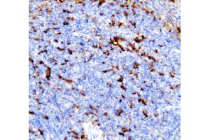 Anti-TREM1 antibody, IHC(P) IHC(P): Mouse Spleen Tissue