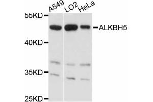 Western blot analysis of extracts of various cell lines, using ALKBH5 antibody (ABIN4902897) at 1:3000 dilution. (ALKBH5 anticorps)