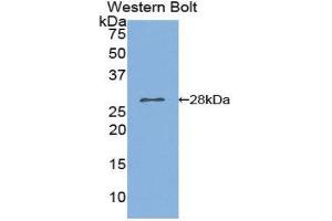Western Blotting (WB) image for anti-Phospholipase A2, Group VI (Cytosolic, Calcium-Independent) (PLA2G6) (AA 481-702) antibody (ABIN1859465) (PLA2G6 anticorps  (AA 481-702))