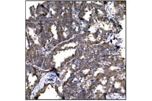 IHC analysis of Caspase-9/CASP9 using anti-Caspase-9/CASP9 antibody (ABIN7600340). (Caspase 9 anticorps  (AA 18-416))