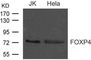 Western blot analysis of extract from JK and Hela cells using FOXP4 Antibody (FOXP4 anticorps)