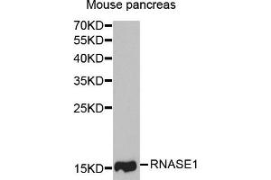 Western Blotting (WB) image for anti-Ribonuclease, RNase A Family, 1 (Pancreatic) (RNASE1) antibody (ABIN1882329) (RNASE1 anticorps)