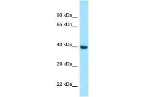 WB Suggested Anti-MC1R Antibody Titration: 1. (MC1 Receptor anticorps  (C-Term))