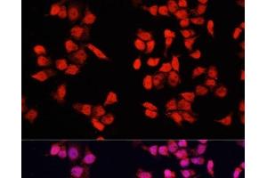 Immunofluorescence analysis of HeLa cells using YBX1 Polyclonal Antibody at dilution of 1:100. (YBX1 anticorps)