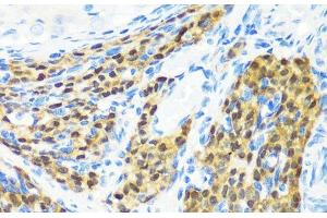 Immunohistochemistry of paraffin-embedded Rat ovary using KMT2E Polyclonal Antibody at dilution of 1:200 (40x lens). (MLL5/KMT2E anticorps)