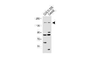 All lanes : Anti-TNIK Antibody at 1:1000 dilution Lane 1: COLO 205 whole cell lysate Lane 2:Caco2 whole cell lysate Lysates/proteins at 20 μg per lane. (TNIK anticorps  (Ser764))
