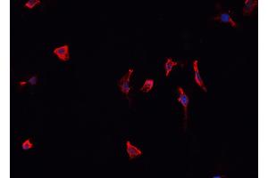 ABIN6266503 staining K-562 cells by IF/ICC.