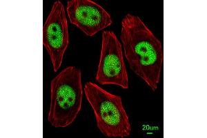 Immunofluorescent analysis of  cells, using KLF4 Antibody f.