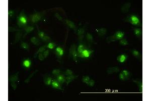 Immunofluorescence of monoclonal antibody to ANXA2 on HeLa cell.