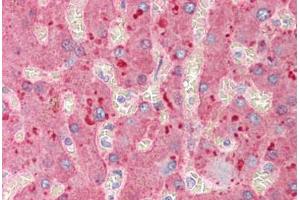 Human Liver (formalin-fixed, paraffin-embedded) stained with A2M antibody ABIN291670 at 2. (alpha 2 Macroglobulin anticorps)