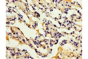 Immunohistochemistry of paraffin-embedded human lung tissue using ABIN7150056 at dilution of 1:100