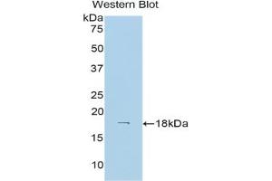Western blot analysis of the recombinant protein. (Hexokinase 1 anticorps  (AA 137-270))