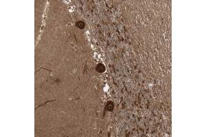 Immunohistochemical staining of human cerebellum with C10orf113 polyclonal antibody  shows strong cytoplasmic nucleolar positivity in Purkinje cells at 1:50-1:200 dilution. (C10orf113 anticorps)