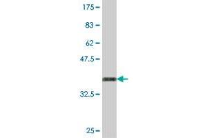 Western Blot detection against Immunogen (37. (TRIM33 anticorps  (AA 1006-1105))