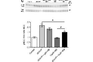 Ex vivo studies on isolated cortical tubules from mouse kidney highlight a role for CAMKK and PI3K in VP signaling in mpkDCT cells.