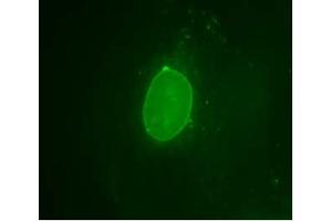 Image no. 2 for anti-Emerin (EMD) (AA 114-183) antibody (ABIN303590) (Emerin anticorps  (AA 114-183))