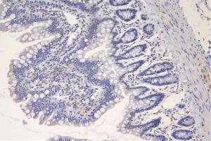 IHC analysis of TRAF6 using anti-TRAF6 antibody (ABIN7600026). (TRAF6 anticorps  (AA 14-512))