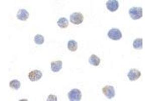 Immunocytochemistry of IKK alpha in Jurkat cells with AP30403PU-N IKK alpha antibody at 1μg/ml.