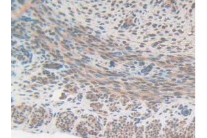 IHC-P analysis of Mouse Uterus Tissue, with DAB staining. (CS anticorps  (AA 174-428))