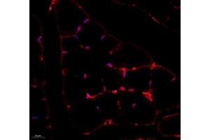 Immunofluorescence of paraffin embedded rat Bone fibroids using SMYD2 (ABIN7075581) at dilution of 1:2000 (400x lens)
