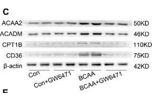 BCAA upregulate PPAR-α and PPAR-α targeted genes. (Medium-Chain Specific Acyl-CoA Dehydrogenase, Mitochondrial (MCAD) (AA 1-220) anticorps)