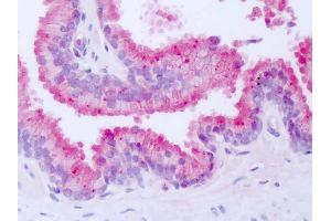 Anti-NR1D1 antibody IHC of human prostate.