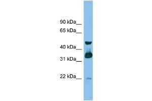 WB Suggested Anti-GBL Antibody Titration: 0. (GBL anticorps  (Middle Region))