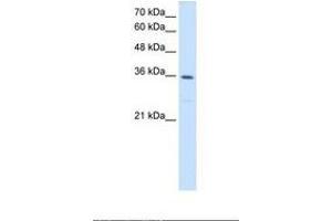Image no. 1 for anti-Methylenetetrahydrofolate Dehydrogenase (NADP+ Dependent) 2, Methenyltetrahydrofolate Cyclohydrolase (MTHFD2) (AA 133-182) antibody (ABIN321016)