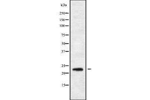 Western blot analysis of RAB30 using K562 whole cell lysates (RAB30 anticorps  (C-Term))