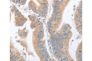 Immunohistochemistry (IHC) image for anti-Par-6 Partitioning Defective 6 Homolog alpha (PARD6A) antibody (ABIN2421992) (PARD6A anticorps)