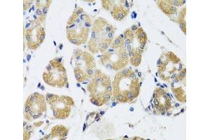 Immunohistochemistry of paraffin-embedded Human stomach using RAD51C Polyclonal Antibody at dilution of 1:100 (40x lens). (RAD51C anticorps)