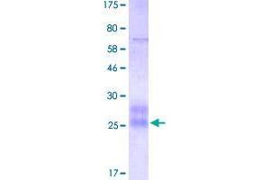 SDS-PAGE (SDS) image for Tumor Necrosis Factor Receptor Superfamily, Member 19 (TNFRSF19) (AA 30-170) protein (His-DYKDDDDK-Strep II Tag) (ABIN4369899)