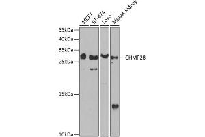 Western blot analysis of extracts of various cell lines, using CHMP2B antibody (ABIN6131571, ABIN6138545, ABIN6138547 and ABIN6217398) at 1:1000 dilution. (CHMP2B anticorps  (AA 1-213))