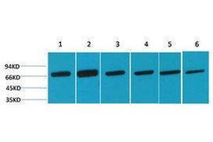 Western Blotting (WB) image for anti-Heat Shock 70kDa Protein 8 (HSPA8) antibody (ABIN3179025) (Hsc70 anticorps)